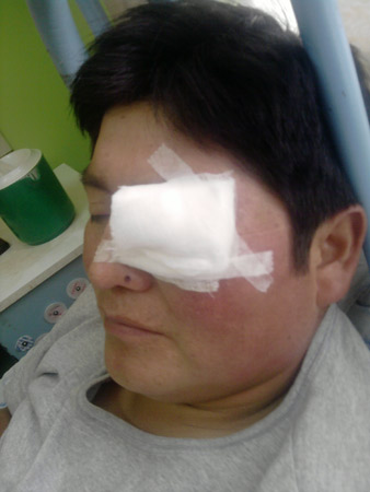 Mapuches heridos